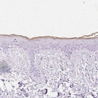 Immunohistochemical staining of human skin shows moderate membranous positivity in squamous epithelial cells.