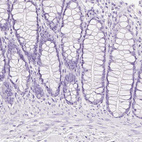 Immunohistochemical staining of human colon shows no positivity in glandular cells as expected.