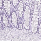Immunohistochemical staining of human colon shows no positivity in glandular cells as expected.