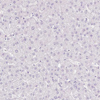 Anti-TGM1 Antibody
