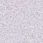 Immunohistochemical staining of human liver shows no positivity in hepatocytes as expected.