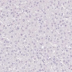 Immunohistochemical staining of human liver shows no positivity in hepatocytes as expected.