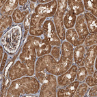Immunohistochemical staining of human kidney shows moderate cytoplasmic positivity in cells in tubules.