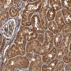 Immunohistochemical staining of human kidney shows moderate cytoplasmic positivity in cells in tubules.