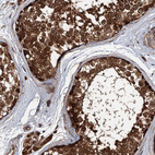 Immunohistochemical staining of human testis shows strong cytoplasmic positivity in cells in seminiferous ducts.