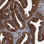 Immunohistochemical staining of human fallopian tube shows strong cytoplasmic positivity in glandular cells.