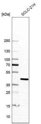Western blot analysis in human cell line SCLC-21H.