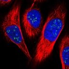 Immunofluorescent staining of human cell line U-2 OS shows localization to nucleoli fibrillar center.