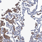 Anti-FAM214A Antibody