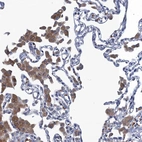 Immunohistochemical staining of human lung shows moderate cytoplasmic positivity in macrophages.