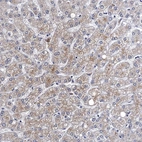 Immunohistochemical staining of human liver shows weak to moderate cytoplasmic positivity in hepatocytes.