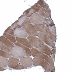 Immunohistochemical staining of human skeletal muscle shows weak to moderate cytoplasmic positivity in myocytes.