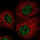 Immunofluorescent staining of human cell line A-431 shows localization to nucleoplasm.