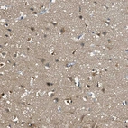 Immunohistochemical staining of human cerebral cortex shows weak cytoplasmic positivity in neurons.