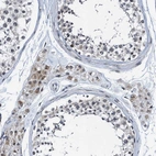 Immunohistochemical staining of human testis shows weak cytoplasmic positivity in Leydig cells.