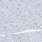 Immunohistochemical staining of human skeletal muscle shows no positivity in myocytes as expected.