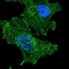Immunofluorescent staining of human cell line U-251 MG shows localization to nucleoplasm, plasma membrane, mitochondria & focal adhesion sites.