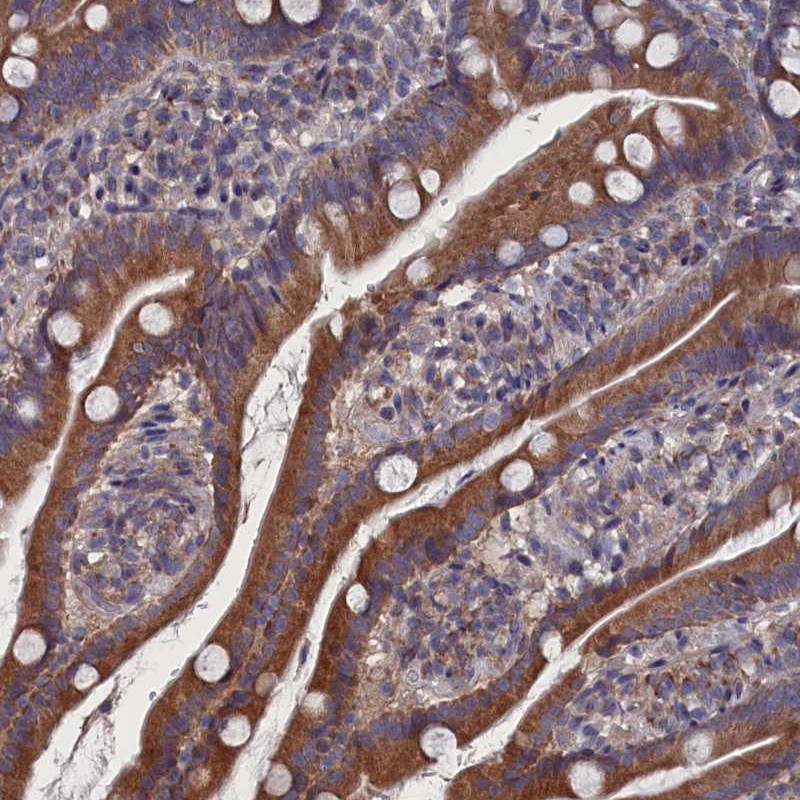 Anti-SPATA13 Antibody