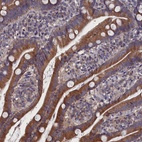 Anti-SPATA13 Antibody