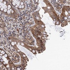 Anti-TMEM39B Antibody