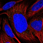 Immunofluorescent staining of human cell line U-2 OS shows localization to vesicles.