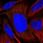 Immunofluorescent staining of human cell line U-2 OS shows localization to vesicles.