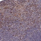 Anti-SEC24C Antibody