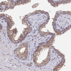Immunohistochemical staining of human prostate shows moderate granular cytoplasmic positivity in glandular cells.