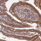 Immunohistochemical staining of human duodenum shows strong granular cytoplasmic positivity in glandular cells.