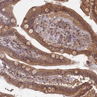 Immunohistochemical staining of human duodenum shows strong granular cytoplasmic positivity in glandular cells.