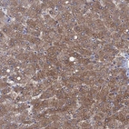 Immunohistochemical staining of human liver shows strong cytoplasmic positivity in hepatocytes.