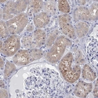 Immunohistochemical staining of human kidney shows moderate cytoplasmic positivity in cells in tubules.
