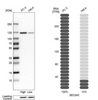 Western blot analysis in human cell lines PC-3 and HeLa using Anti-SEC24C antibody. Corresponding SEC24C RNA-seq data are presented for the same cell lines. Loading control: Anti-HSP90B1.