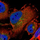 Immunofluorescent staining of human cell line U-251 MG shows localization to nucleoplasm & vesicles.