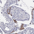 Immunohistochemical staining of human testis shows strong cytoplasmic positivity in Leydig cells.