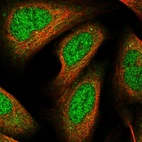 Immunofluorescent staining of human cell line U-2 OS shows localization to nucleoplasm & cytosol.