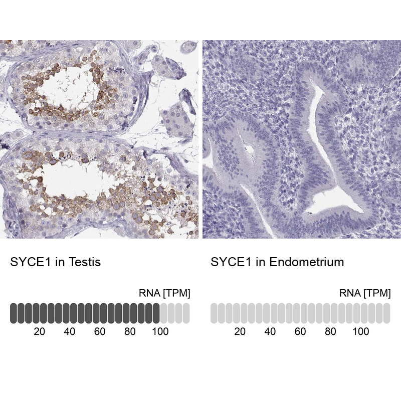 Anti-SYCE1 Antibody