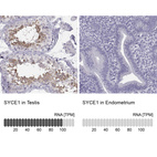 Anti-SYCE1 Antibody