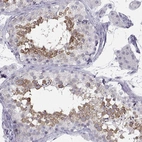 Immunohistochemical staining of human testis shows high expression.
