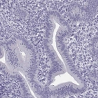 Immunohistochemical staining of human endometrium shows low expression as expected.