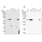 Anti-ZDHHC16 Antibody
