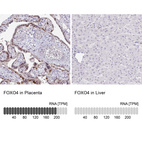 Anti-FOXO4 Antibody