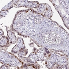 Immunohistochemical staining of human placenta shows strong nuclear positivity in trophoblastic cells.