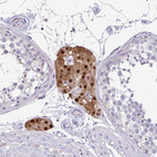 Anti-FOXO4 Antibody