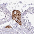 Immunohistochemical staining of human testis shows strong nuclear positivity in Leydig cells.