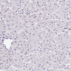 Anti-FOXO4 Antibody