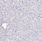 Immunohistochemical staining of human liver shows no positivity in hepatocytes as expected.