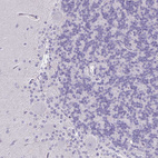 Anti-FOXO4 Antibody