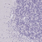 Immunohistochemical staining of human cerebellum shows no positivity in Purkinje cells as expected.