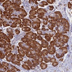 Anti-TMEM18 Antibody